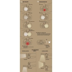 Essential Elements - Head & Beam 450